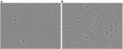 Transcriptional response of the xerotolerant Arthrobacter sp. Helios strain to PEG-induced drought stress